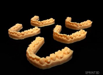 3D печать в стоматологии Превью