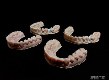 3D печать в стоматологии